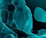 X-ray Microscopy: An Overview