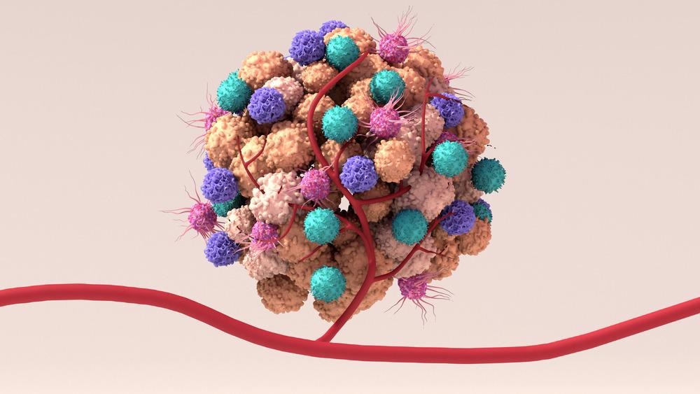 Tumor Cells