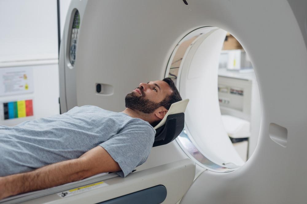 MRI Scan