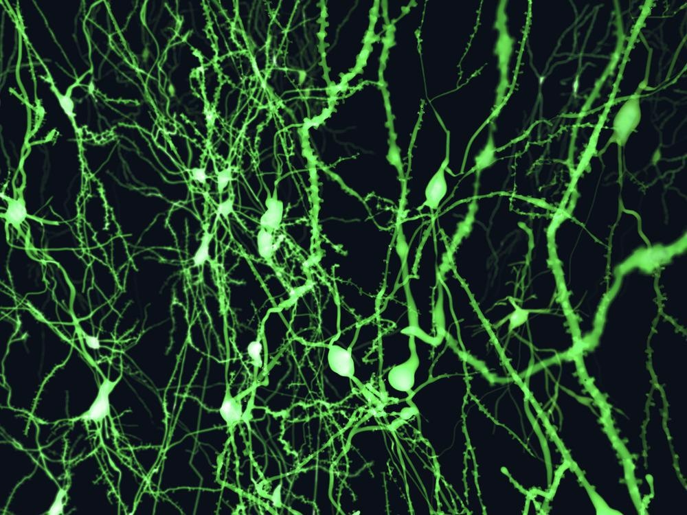 Neurons marked by fluorescence