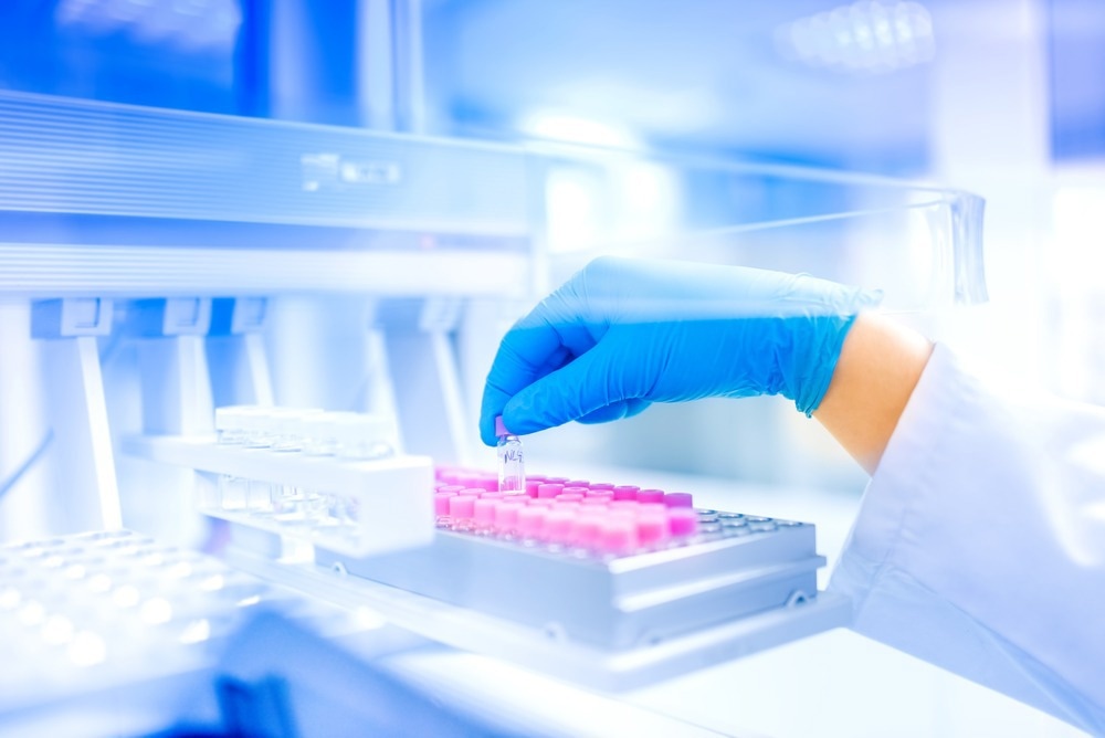 Sample Preparation