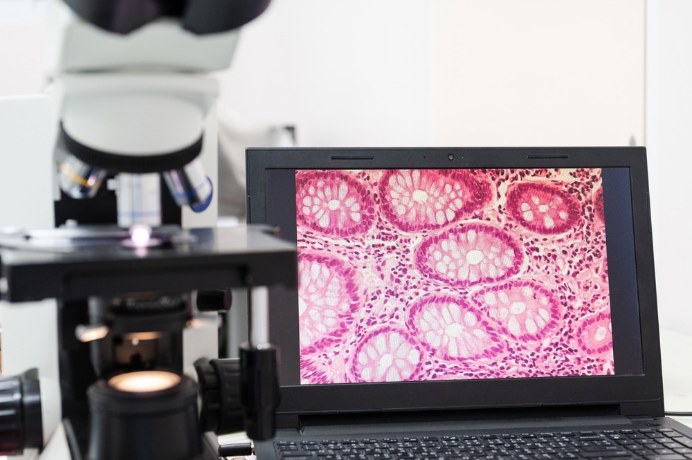 Tissue Imaging