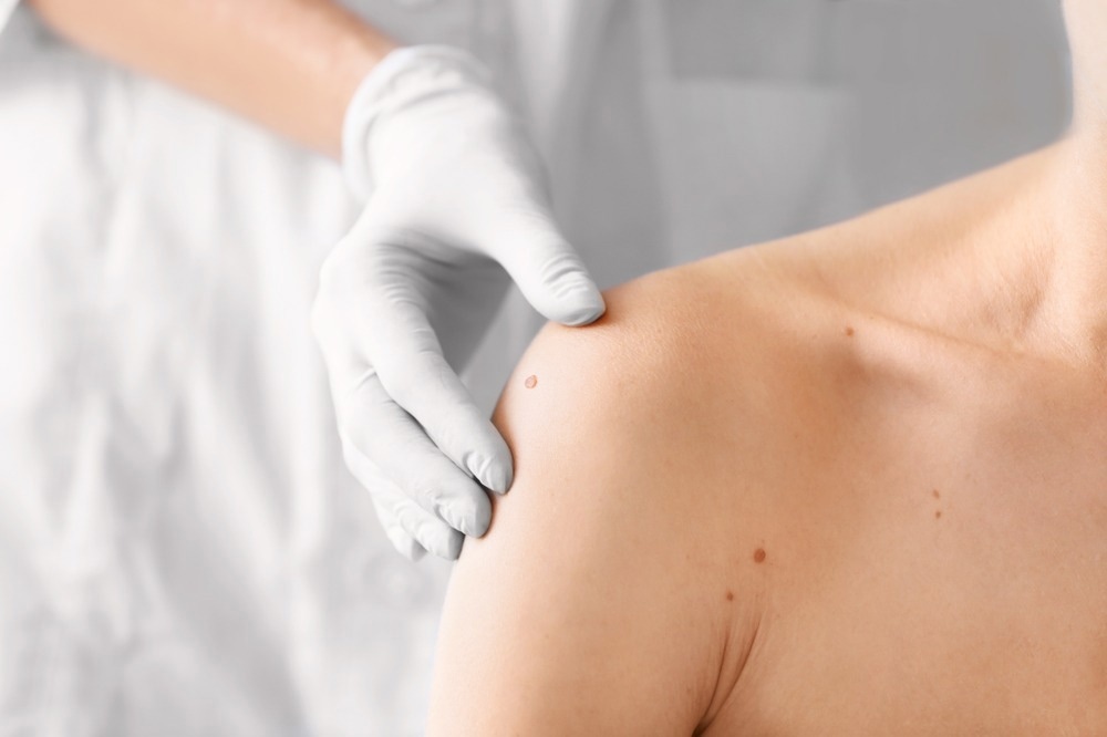 Dermatology