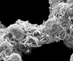 Global Market Report: Electron Microscopy