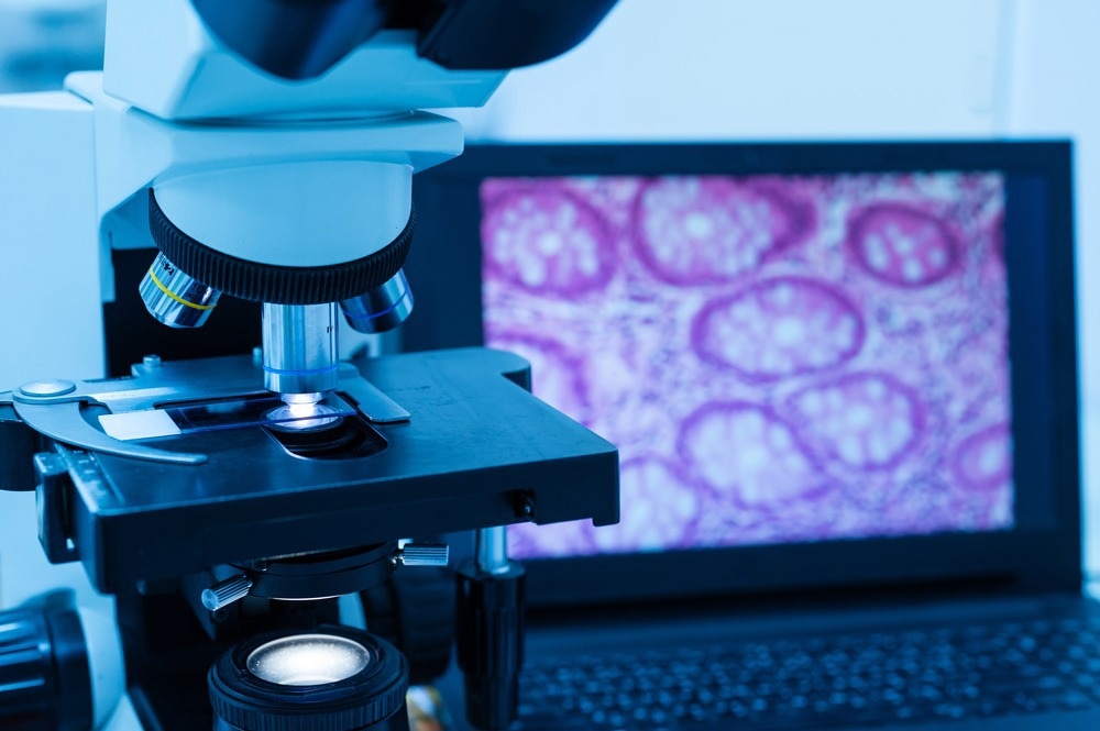 Digital Microscope