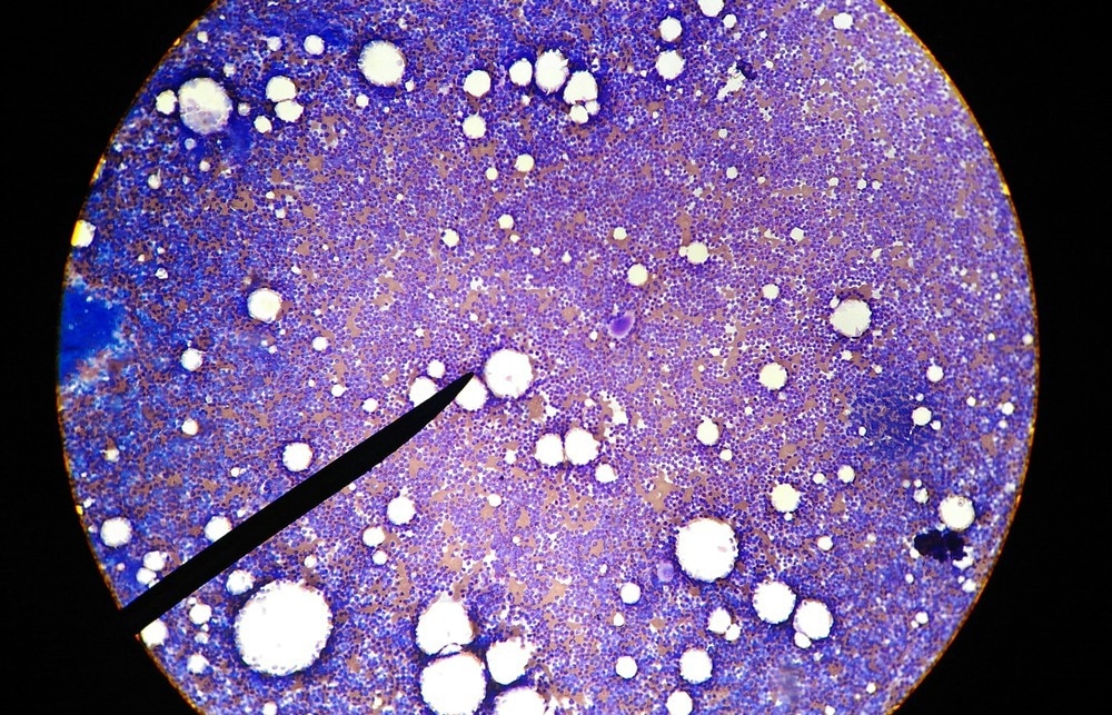 Blood Cells