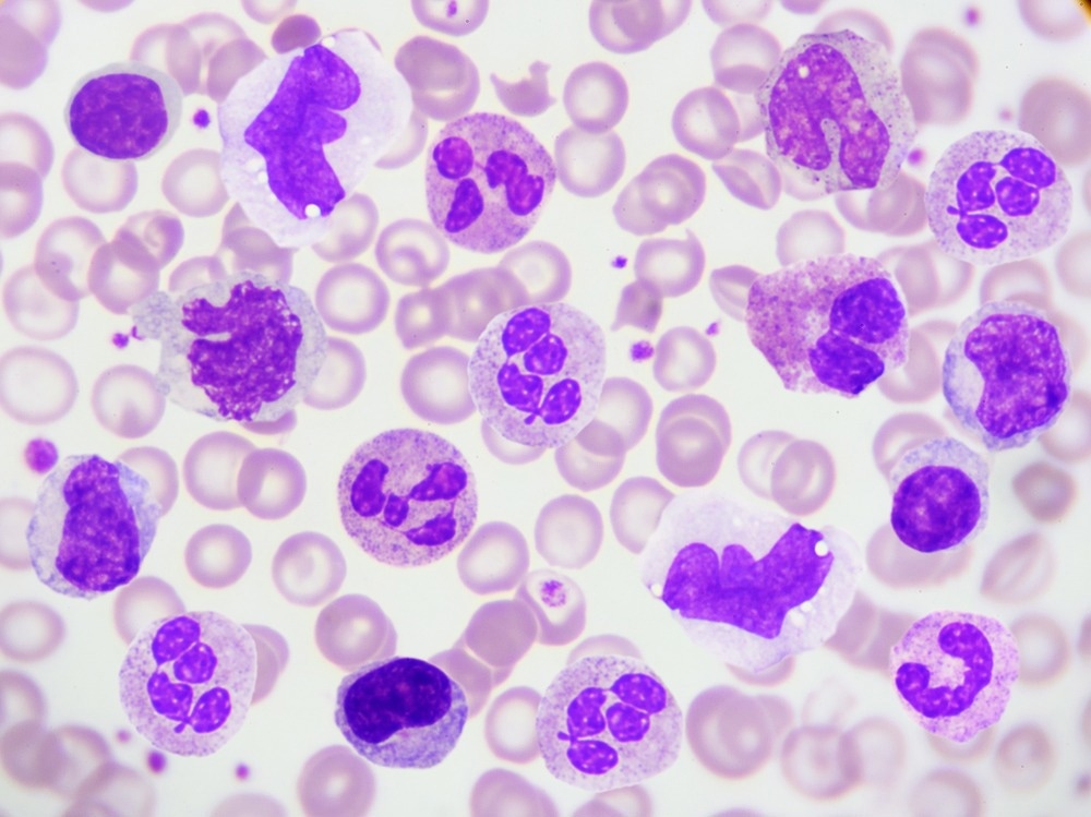 White Blood Cells