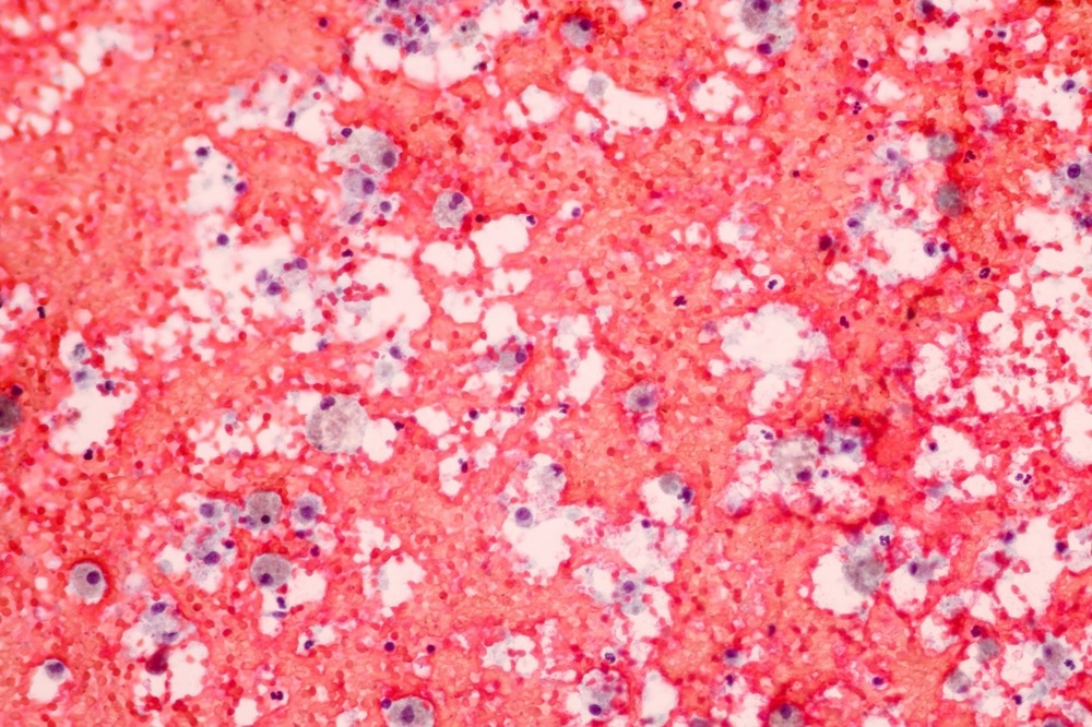 Macrophages