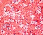 What Role do Macrophages Play in Immunology?