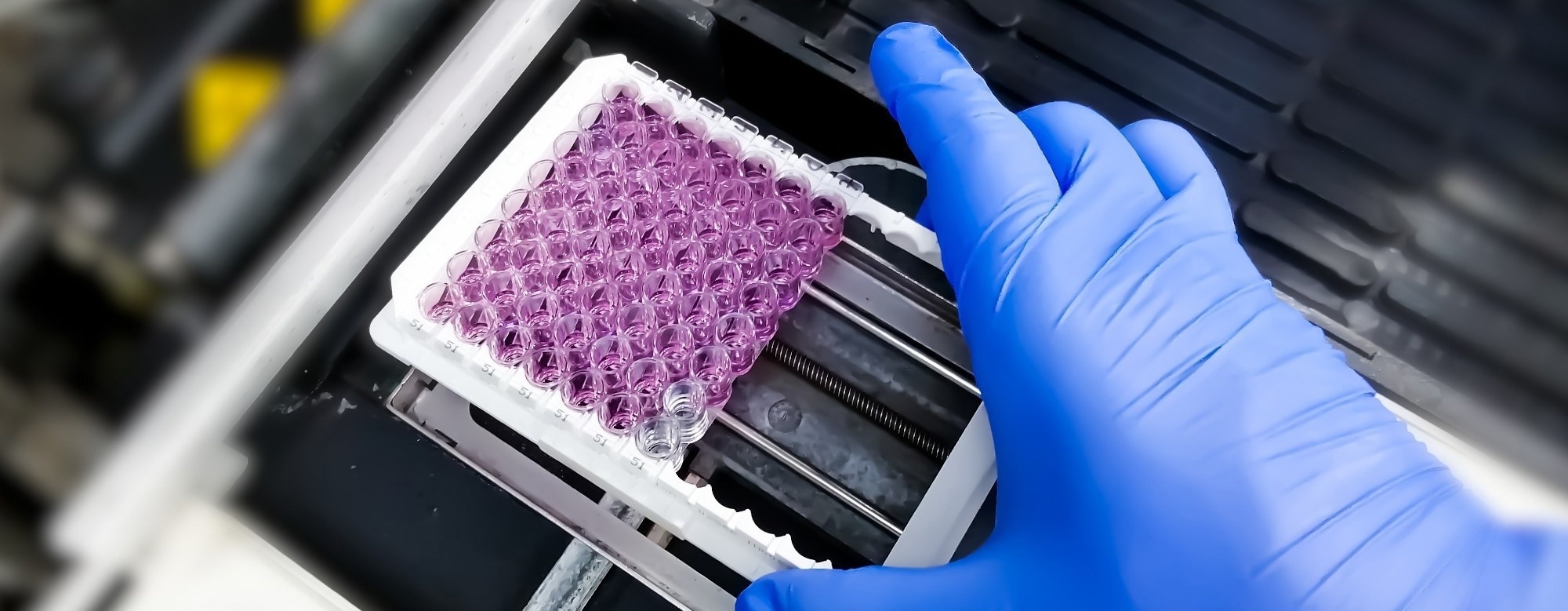 How Is Estrogenic Activity Measured in the Environment?