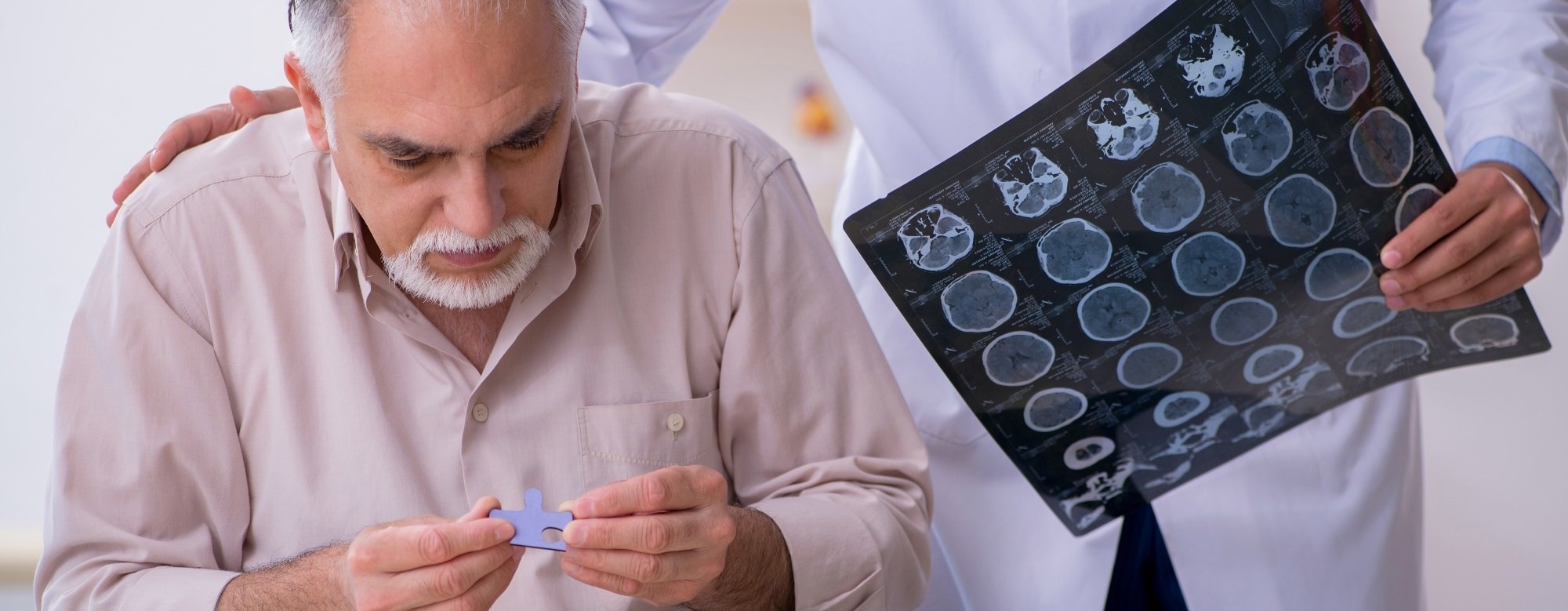 Blood Tau217 Test Predicts When Alzheimer’s Symptoms May Begin
