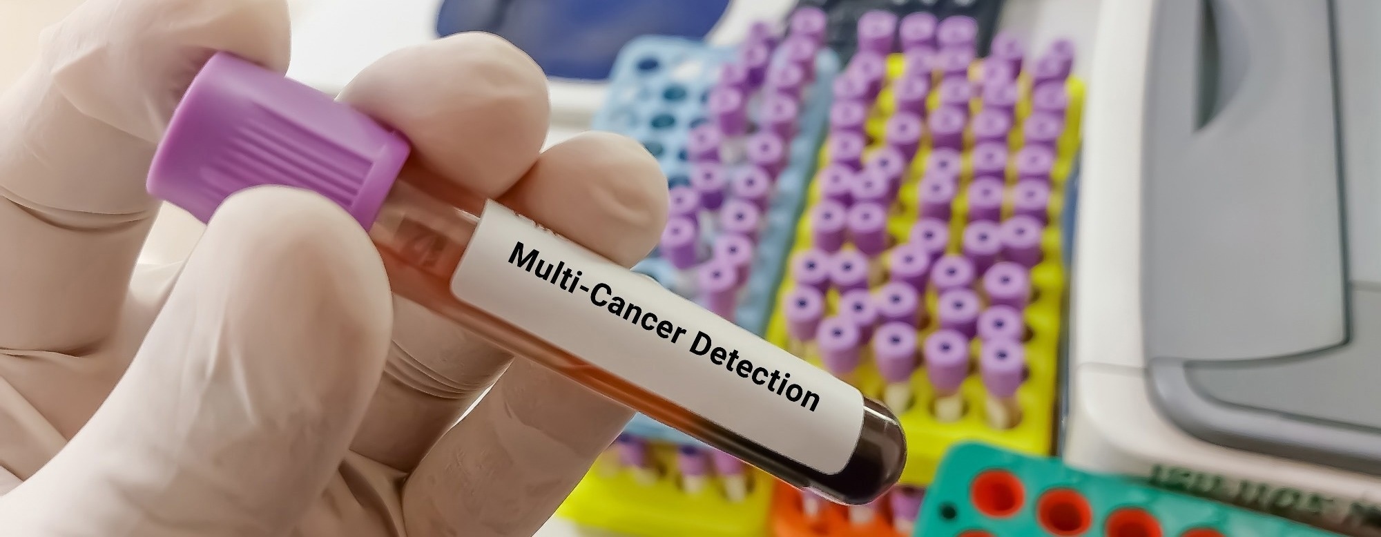 Multi-Cancer Early Detection: How Blood Tests Are Transforming Cancer Screening
