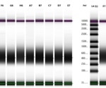 The Importance of Robust Automation-Friendly Library Preparation for Handling Precious Samples