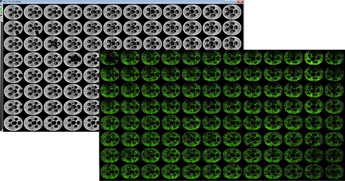 TL image of 3D printed pluronic pillar arrays captured using ImageXpress Micro Confocal system (4X) (left–grey panel). Plate representations of uniformly seeded HepG2 cells in collagen I after pluronic pillars were washed (right – green panel). The holes in the dense collagen matrix enabled for better exchange of nutrients and gases. This eventually prevents the cells in the center of the matrix from undergoing necrosis