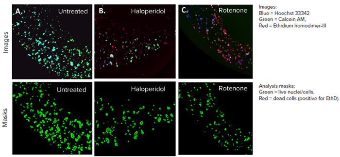 HepG2 3D cell model confocal images, 4X single site image (top panel), and their representative live analysis masks generated by MetaXpress software (bottom panel) A) Untreated control, B) Haloperidol (20 μM), C) Rotenone (4 μM). The control wells had more HepG2 cells and lower cell death whereas, the treated cells had more red-stained cells and a lower number of live cells, indicating cell death
