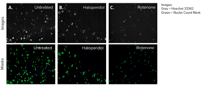 HepG2 3D cell model DAPI images, 10X single site image (top panel), and their representative nuclei count analysis masks generated by MetaXpress software (bottom panel) A) Untreated control, B) Haloperidol (4 μM), C) Rotenone (4 μM). The DAPI mask counted the number of nuclei present in each site and the control (A) had the most nuclei owing to no toxicity