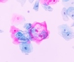 Revolutionizing Tissue Diagnostics with Precision Spectroscopy