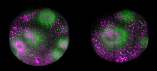 Tubulin assembly in cytoplasmic droplet, acquired on Viventis LS1 light-sheet microscope with Orca Fusion BT camera, (scale 100 μm)