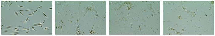 Cells of Phaeodactylum tricornutum before (left) and after cell disruption (right) with the MM 400 in combination with the Falcon tube adapter.