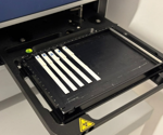 High-Precision PSA Testing with Advanced Detection Technology
