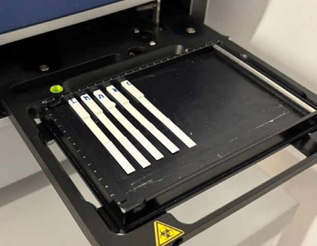 High-Precision PSA Testing with Advanced Detection Technology