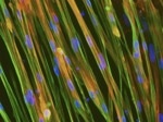 ioSkeletal Myocytes™