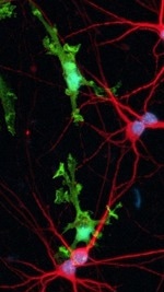 ioMicroglia™