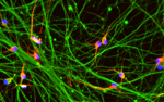ioGlutamatergic Neurons HTT 50CAG/WT™