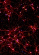 ioGlutamatergic Neurons MAPT P301S/P301S™