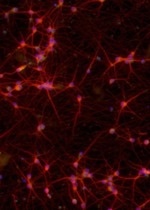 ioGlutamatergic Neurons MAPT P301S/WT™