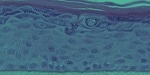 EpiDerm™