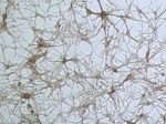Normal Human Melanocytes
