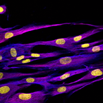 Normal Human Dermal Fibroblasts
