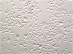Normal Human Bronchial Epithelial Cells