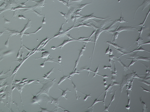 Normal Human Bronchial Fibroblasts