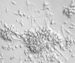 Human Dendritic Immune Cells