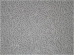 Normal Human Corneal Epithelial Cells