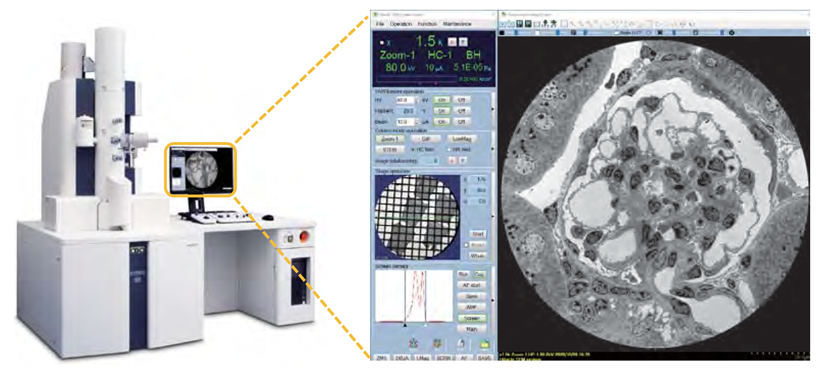 The HT7800: A Versatile Transmission Electron Microscope