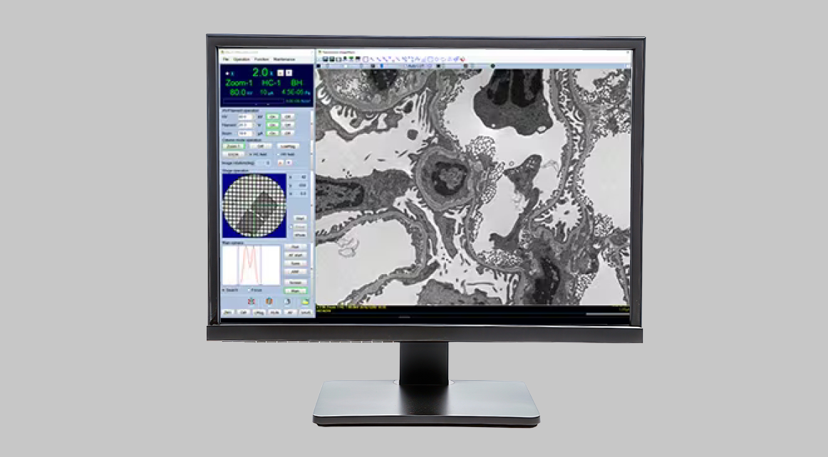 The HT7800: A Versatile Transmission Electron Microscope