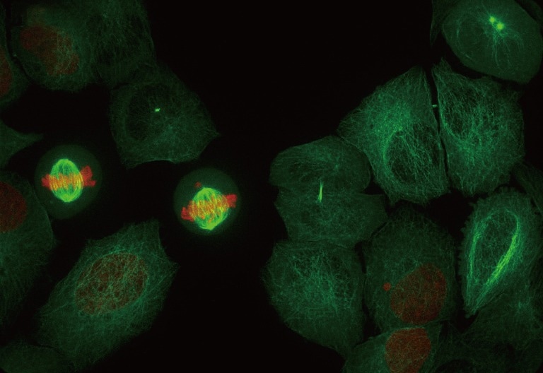 Super resolution images from ORCA-Quest. qCMOS camera/4.6 μm pixel size