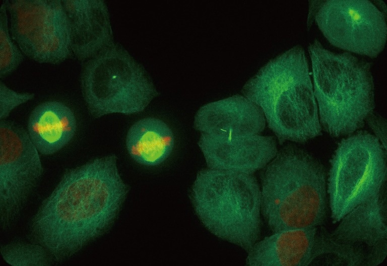 Super resolution images from ORCA-Fusion. Gen III sCMOS camera/6.5 μm pixel size