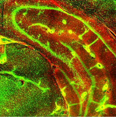 Visikol® HISTO™