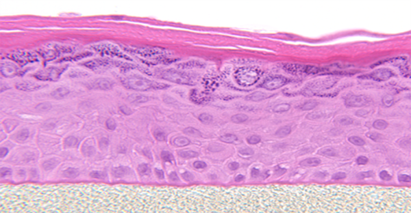 EpiDerm™