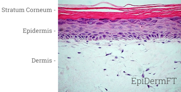 EpiDermFT™