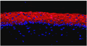 EpiDermFT™
