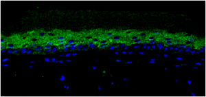 EpiDermFT™