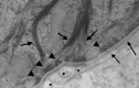 EpiDermFT™