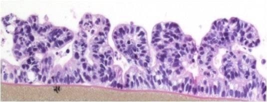 EpiIntestinal™
