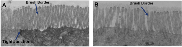 EpiIntestinal™
