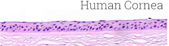 EpiOcular™